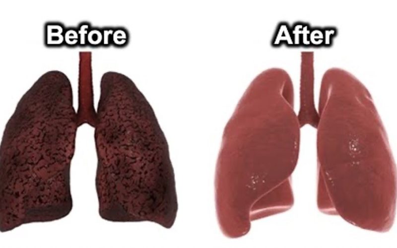 What Happens When You Quit Smoking